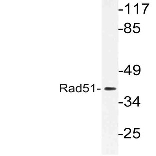 Rad51 (L302) pAb