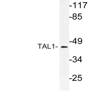 TAL1 (G116) pAb