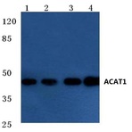 ACAT1 (K266) pAb