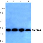 SLC25A6 (R155) pAb