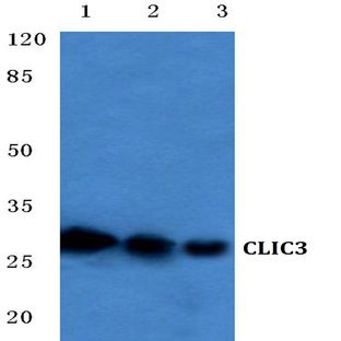 CLIC3 (F56) pAb