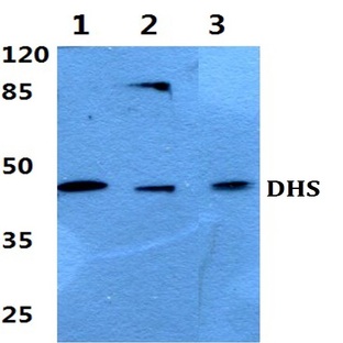 DHS (L87) pAb