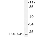 POLR2J1 (D24) pAb