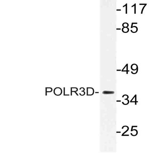 POLR3D (N314) pAb