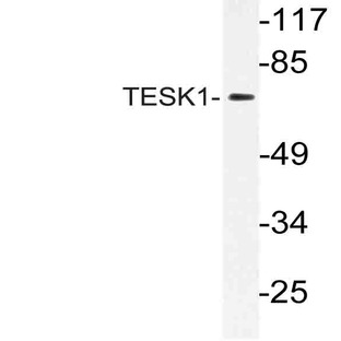 TESK1 (V217) pAb