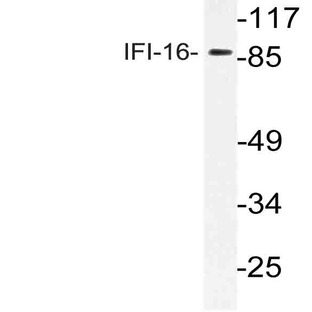 IFI-16 (N772) pAb