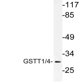 GSTT1/4 (R31) pAb