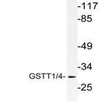 GSTT1/4 (R31) pAb