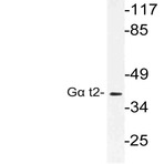 G(alpha) t2 (V34) pAb