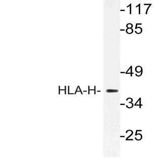 HLA-H (I104) pAb