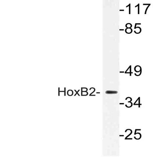 Hox-B2 (P67) pAb