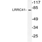 LRRC41 (I432) pAb