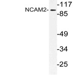 NCAM2 (L296) pAb