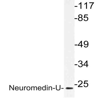 Neuromedin-U (I174) pAb