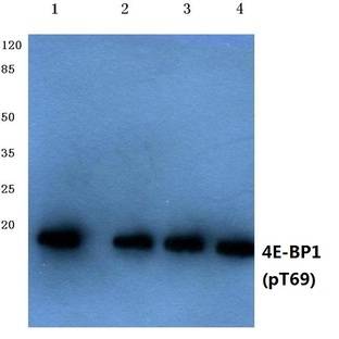 p-4E-BP1 (T69) pAb