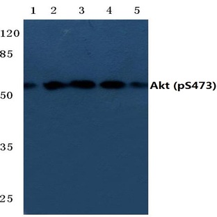 p-AKT (S473) pAb