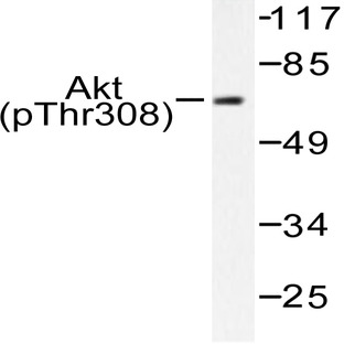 p-AKT (T308) pAb