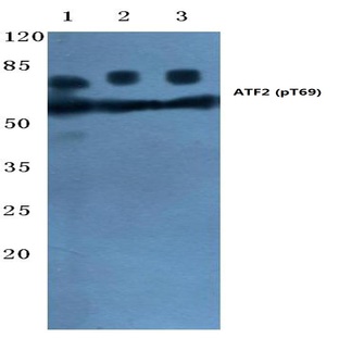 p-ATF2 (T69) pAb