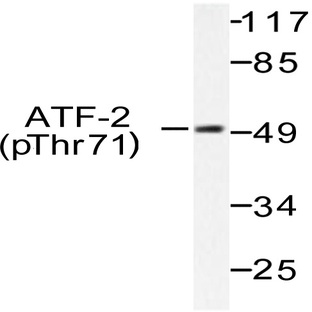 p-ATF2 (T71) pAb