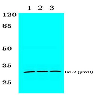 p-Bcl-2 (S70) pAb