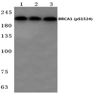 p-BRCA1 (S1524) pAb