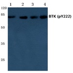 p-BTK (Y222) pAb