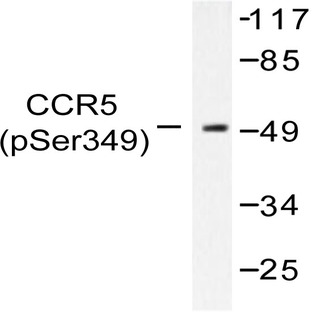 p-CKR-5 (S349) pAb