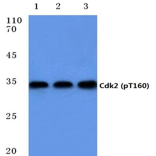 p-Cdk2 (T160) pAb