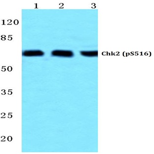 p-Chk2 (S516) pAb