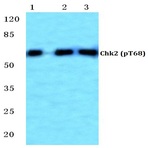 p-Chk2 (T68) pAb