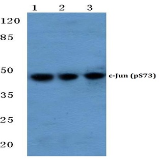 p-c-Jun (S73) pAb