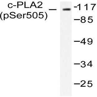 p-cPLA2 (S505) pAb