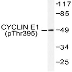 p-Cyclin E1 (T395) pAb