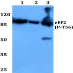 p-EEF2 (T56) pAb