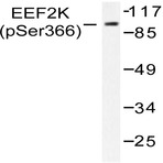 p-eEF2K (S366) pAb