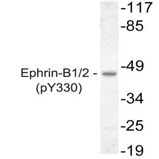 p-Ephrin-B1/2 (Y330)