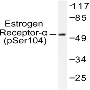 p-ER(alpha) (S104) pAb