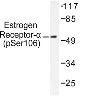 p-ER(alpha) (S106) pAb