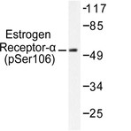 p-ER(alpha) (S106) pAb