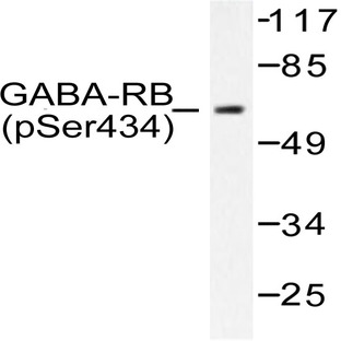 p-GABAA R(beta)1 (S434) pAb