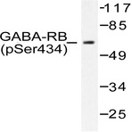 p-GABAA R(beta)1 (S434) pAb