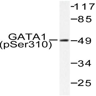 p-GATA1 (S310) pAb