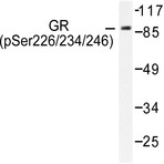 p-GR (S226) pAb