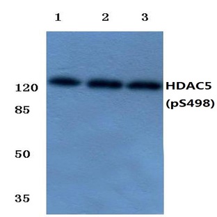 p-HDAC5 (S498) pAb