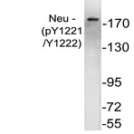  p-ErbB2/HER2 (Y1221/Y1222) pAb