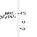 p-ErbB2/HER2 (Y1248) pAb