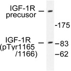 p-IGF-1R (Y1165/Y1166) pAb