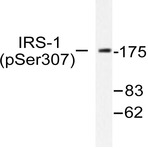 P-IRS-1 (S307) pAb