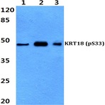 p-Cytokeratin 18 (S33) pAb