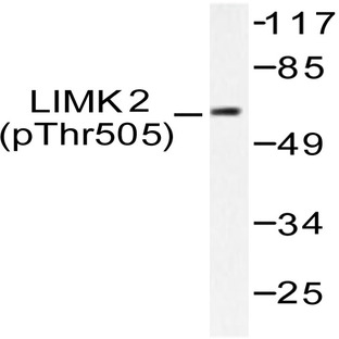 p-LIMK2 (T505) pAb